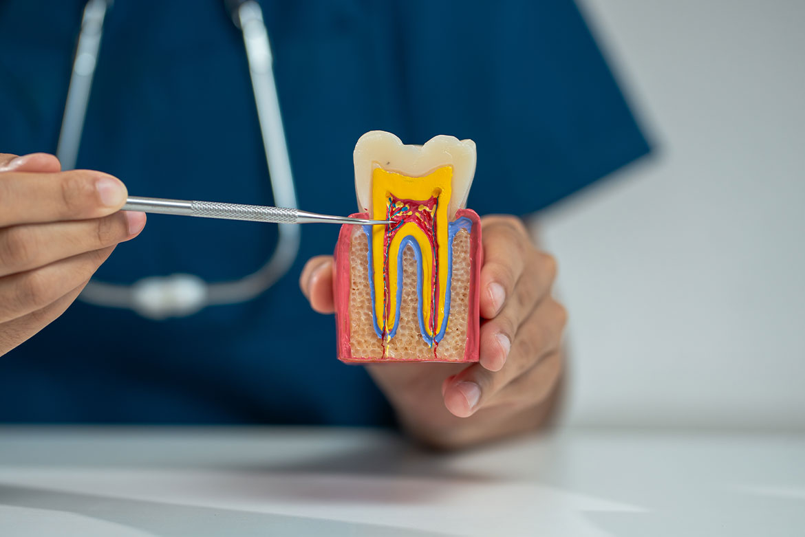 endodonzia acilia Dr. M. Catinari