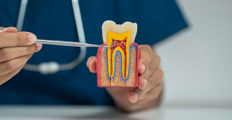 endodonzia acilia Dr. M. Catinari